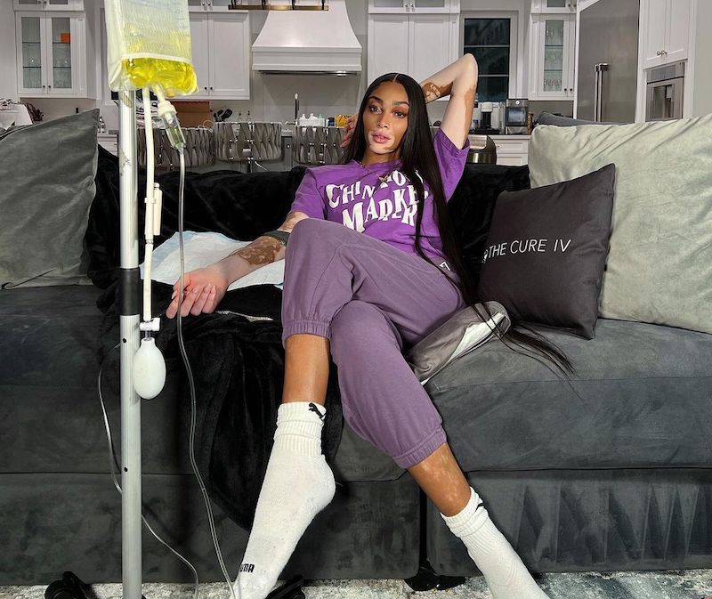 winnie-harlow-sitting-on-sofa - The Paris Post Winnie Harlow | I was never raised as the daughter with vitiligo