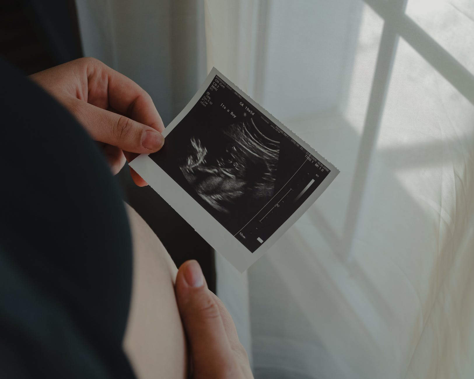 pexels-photo-6565036 - The Paris Post person holding an ultrasound scan photo