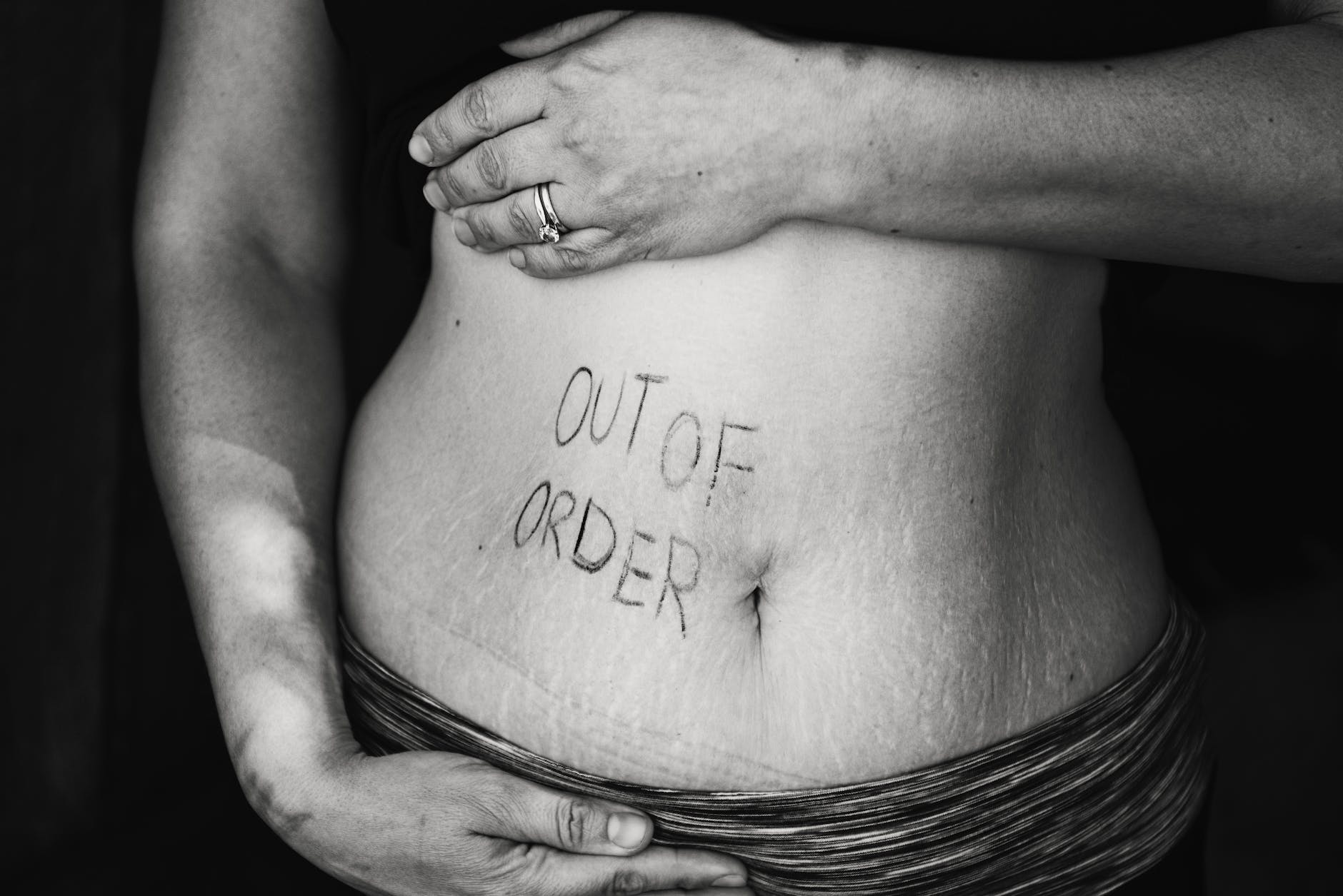 pexels-photo-735966 - The Paris Post Self-hating after pregnancy stretch marks remove naturally out of order text on persons belly
