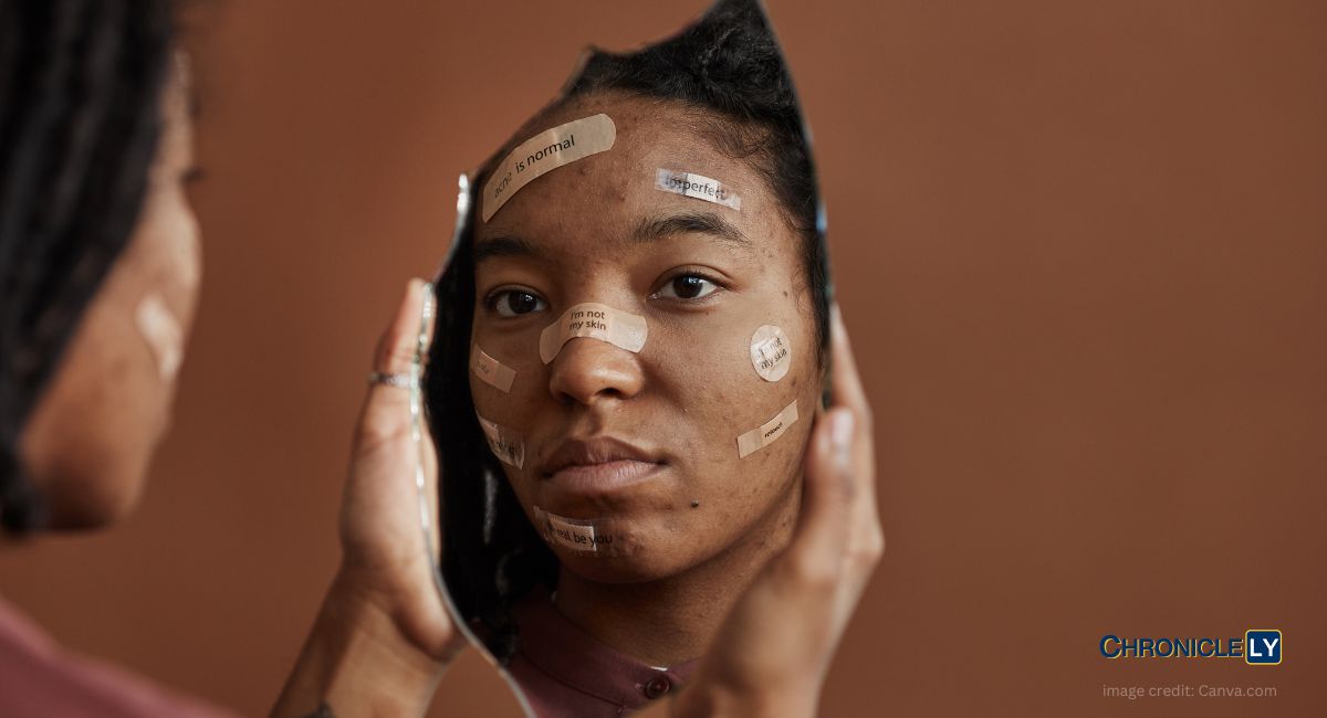 In the depths of our minds, where vulnerabilities reside, lies a sanctuary seeking understanding. Amid body shaming, empathy is the healing balm.